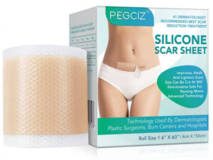 Rola cu Gel de Silicon pentru Imbunatatirea Aspectului Cicatricilor